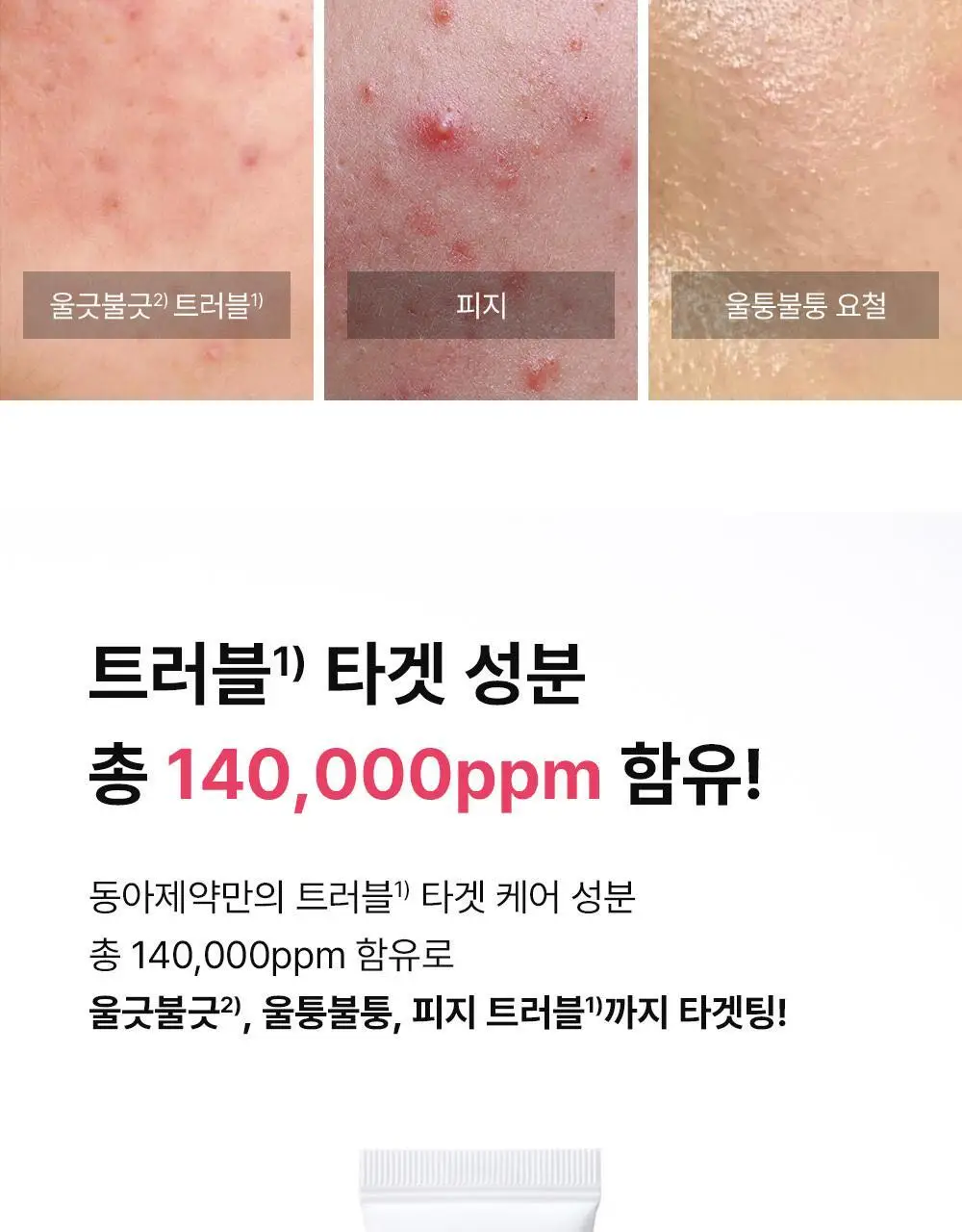 [트러블표적케어] 동아제약 아크네 프로 크림제 30ml 상세페이지 7